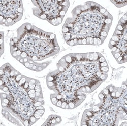 SP100 Antibody, Novus Biologicals:Antibodies:Primary Antibodies
