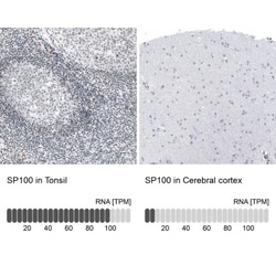 SP100 Antibody, Novus Biologicals:Antibodies:Primary Antibodies