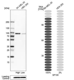 SP100 Antibody, Novus Biologicals:Antibodies:Primary Antibodies
