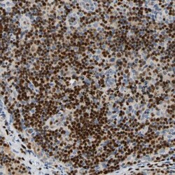 SP140 Antibody, Novus Biologicals:Antibodies:Primary Antibodies