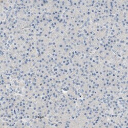 SP140 Antibody, Novus Biologicals:Antibodies:Primary Antibodies