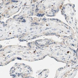 SP140 Antibody, Novus Biologicals:Antibodies:Primary Antibodies
