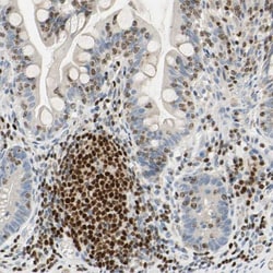 SP140 Antibody, Novus Biologicals:Antibodies:Primary Antibodies