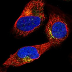 SP17 Antibody, Novus Biologicals:Antibodies:Primary Antibodies