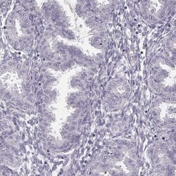 SP17 Antibody, Novus Biologicals:Antibodies:Primary Antibodies