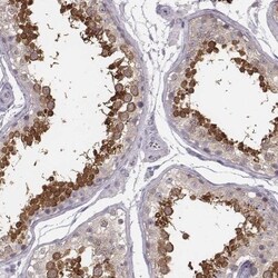 SP17 Antibody, Novus Biologicals:Antibodies:Primary Antibodies