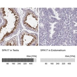 SP17 Antibody, Novus Biologicals:Antibodies:Primary Antibodies