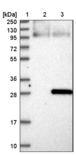 SP17 Antibody, Novus Biologicals:Antibodies:Primary Antibodies