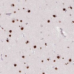 SP9 Antibody, Novus Biologicals 25 &mu;L, Unlabeled:Antibodies, Polyclonal