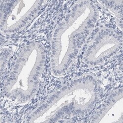 SPACA1 Antibody, Novus Biologicals 0.1mL; Unlabeled:Antibodies, Polyclonal