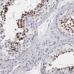 SPACA1 Antibody, Novus Biologicals 0.1mL; Unlabeled:Antibodies, Polyclonal