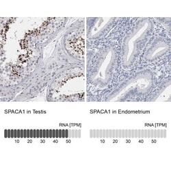 SPACA1 Antibody, Novus Biologicals 0.1mL; Unlabeled:Antibodies, Polyclonal