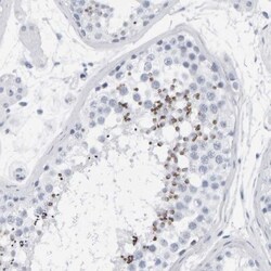 SPACA3 Antibody, Novus Biologicals:Antibodies:Primary Antibodies