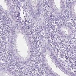 SPACA4 Antibody, Novus Biologicals 0.1mL; Unlabeled:Antibodies, Polyclonal