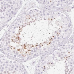 SPACA4 Antibody, Novus Biologicals 0.1mL; Unlabeled:Antibodies, Polyclonal