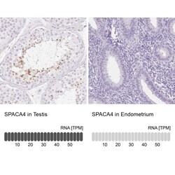 SPACA4 Antibody, Novus Biologicals 0.1mL; Unlabeled:Antibodies, Polyclonal