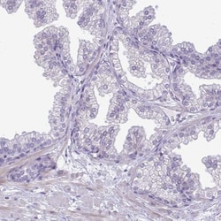 SPAG1 Antibody, Novus Biologicals 0.1mL; Unlabeled:Antibodies, Polyclonal