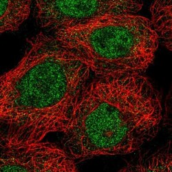 SPAG17 Antibody, Novus Biologicals 0.1mL; Unlabeled:Antibodies, Polyclonal