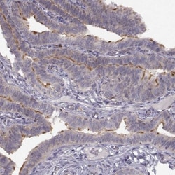 SPAG17 Antibody, Novus Biologicals 0.1mL; Unlabeled:Antibodies, Polyclonal
