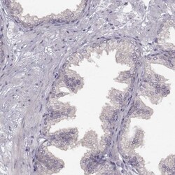 SPAG17 Antibody, Novus Biologicals 0.1mL; Unlabeled:Antibodies, Polyclonal