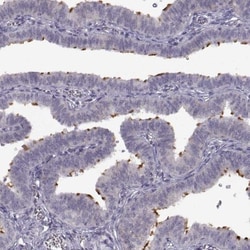 SPAG17 Antibody, Novus Biologicals:Antibodies:Primary Antibodies