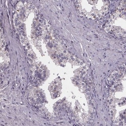 SPAG8 Antibody, Novus Biologicals 0.1mL; Unlabeled:Antibodies, Polyclonal