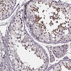 SPAG8 Antibody, Novus Biologicals 0.1mL; Unlabeled:Antibodies, Polyclonal