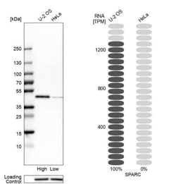 SPARC Antibody, Novus Biologicals:Antibodies:Primary Antibodies