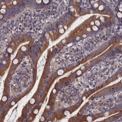 SPATA13 Antibody, Novus Biologicals 0.1mL; Unlabeled:Antibodies, Polyclonal