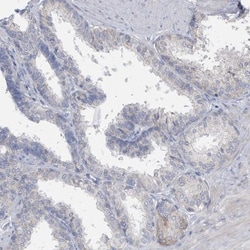 SPATA18 Antibody, Novus Biologicals:Antibodies:Primary Antibodies