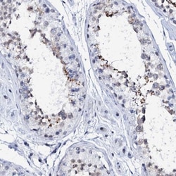 SPATA19 Antibody, Novus Biologicals 0.1mL; Unlabeled:Antibodies, Polyclonal