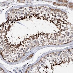 SPATA20 Antibody, Novus Biologicals 0.1mL; Unlabeled:Antibodies, Polyclonal