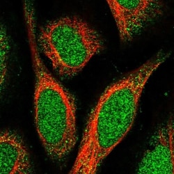 SPATA24 Antibody, Novus Biologicals 25 &mu;L, Unlabeled:Antibodies, Polyclonal