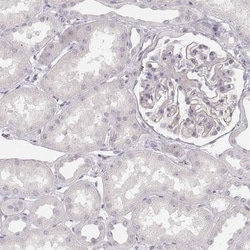 SPATA24 Antibody, Novus Biologicals 25 &mu;L, Unlabeled:Antibodies, Polyclonal