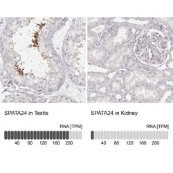 SPATA24 Antibody, Novus Biologicals 25 &mu;L, Unlabeled:Antibodies, Polyclonal