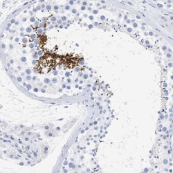 SPATA3 Antibody, Novus Biologicals:Antibodies:Primary Antibodies