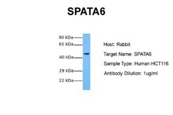 SPATA6 Antibody, Novus Biologicals 0.05mg; Unlabeled:Antibodies, Polyclonal