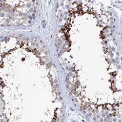 SPATA7 Antibody, Novus Biologicals 0.1mL; Unlabeled:Antibodies, Polyclonal