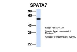 SPATA7 Antibody, Novus Biologicals:Antibodies:Primary Antibodies
