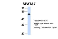 SPATA7 Antibody, Novus Biologicals:Antibodies:Primary Antibodies