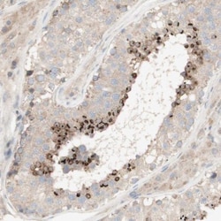 SPATA9 Antibody, Novus Biologicals:Antibodies:Primary Antibodies