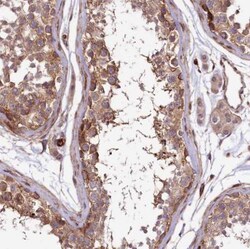 SPATS2 Antibody, Novus Biologicals 25 &mu;L; Unlabeled:Antibodies, Polyclonal