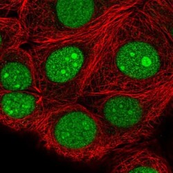 SPC24 Antibody, Novus Biologicals 25 &mu;L | Buy Online | Novus Biologicals | Fisher Scientific