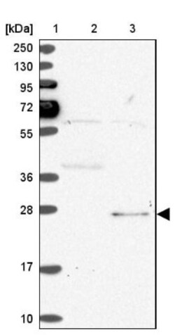 SPC24 Antibody, Novus Biologicals 25 &mu;L | Buy Online | Novus Biologicals | Fisher Scientific