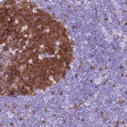 SPC25 Antibody, Novus Biologicals:Antibodies:Primary Antibodies
