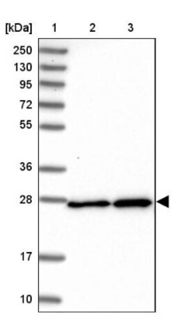SPC25 Antibody, Novus Biologicals:Antibodies:Primary Antibodies