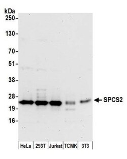 SPCS2 Rabbit anti-Human, Mouse, Polyclonal, Novus Biologicals 100&mu;L;