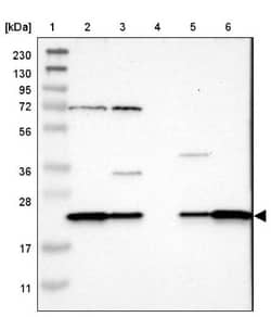 SPCS2 Antibody, Novus Biologicals:Antibodies:Primary Antibodies