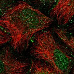 Carboxylesterase 1/CES1 Antibody, Novus Biologicals:Antibodies:Primary