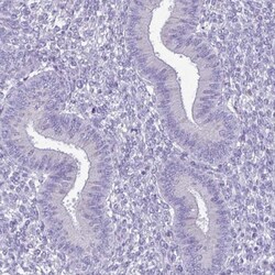 Carboxylesterase 1/CES1 Antibody, Novus Biologicals:Antibodies:Primary